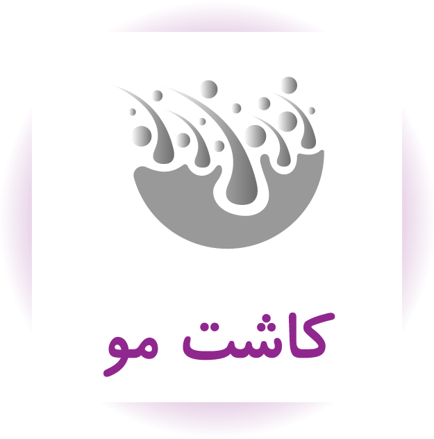 کاشت مو